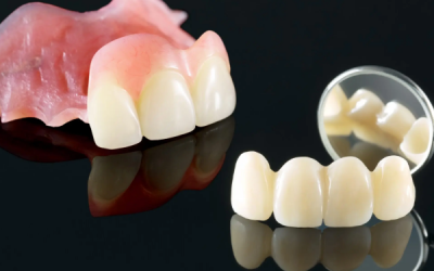 Protesi rimovibile e fissa